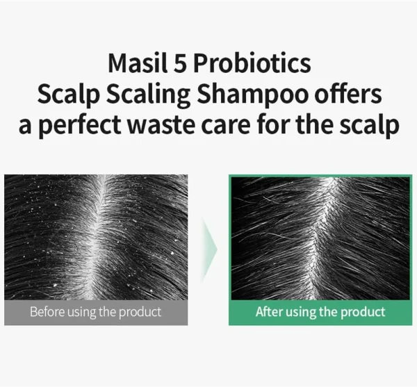 masil-5-probiotics-scalp-scaling-shampoo-pic-4