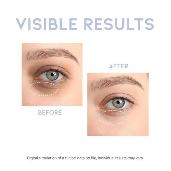 ootd-intensive-eye-serum-30ml-pic-5