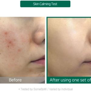 some-by-mi-tea-tree-calming-glow-luminous-ampoule-mask-25g-pic-2