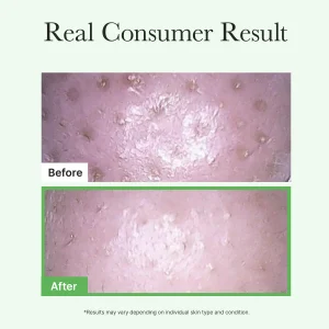 arencia-pore-melt-mochi-cleansing-oil-200ml-pic-8