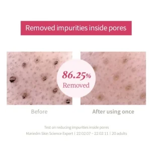 im-from-beet-purifying-mask-70g-pic-2