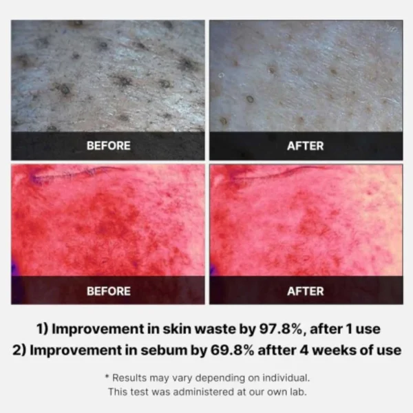 medicube-red-succinic-acid-peeling-pad-70pads-pic-2