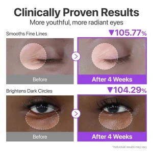 numbuzin-no9-nad-retinol-volumetox-eye-cream-10ml-pic-4