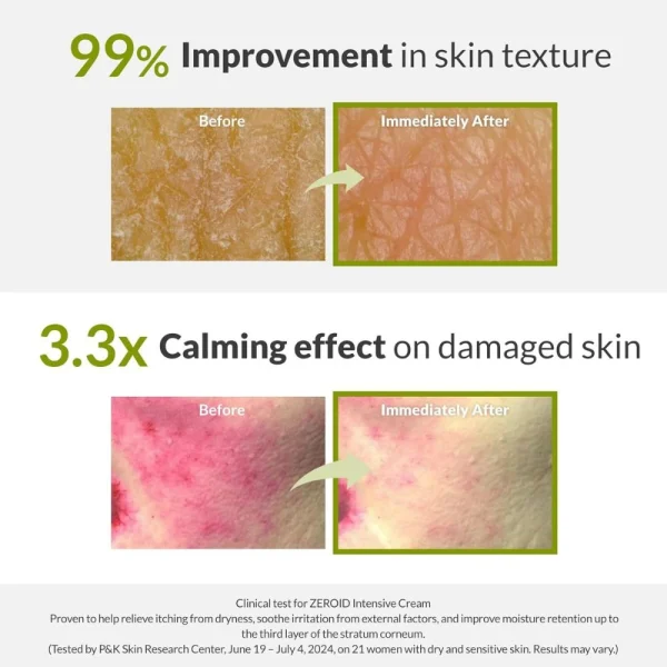 zeroid-intensive-cream-80ml-pic-5
