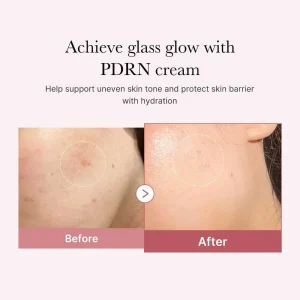 medicube-pdrn-pink-hyaluronic-moisturizing-cream-50ml-pic-5