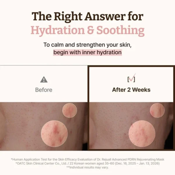 dr-reju-all-advanced-pdrn-rejuvenating-mask-36ml-pic-4
