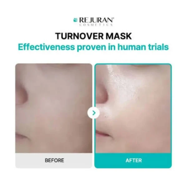 rejuran-turnover-mask-40ml-pic-2